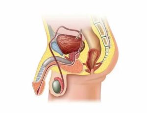 Ночное семяизвержение простатита