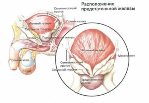 Простата формирование третьей доли что это такое