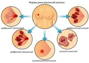 Курага при раке молочной железы