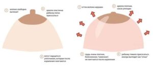 Почему не перестала болеть грудь после начала месячных