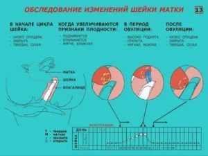 Что значит если начинаются месячные после полового акта