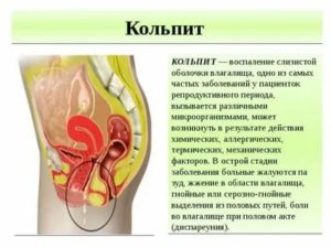 Может ли повышаться температура при вагините