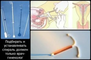 Можно пользоваться тампонами если стоит внутриматочная спираль