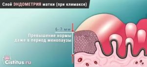 Как уменьшить эндометрий при менопаузе народными средствами
