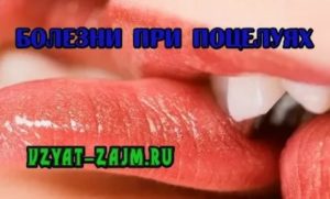 Можно ли заразиться гепатитом с и вич через поцелуй