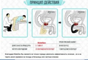 Массажер для простаты vibropros