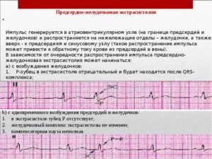 Могут ли быть в месячные экстрасистолы