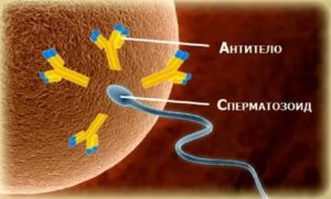 Лечение иммунологической несовместимости супругов при бесплодии