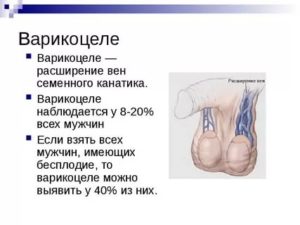 Повреждение семенной канатик бесплодие