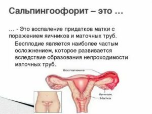 Можно ли ставить спираль при хроническом воспалении яичников
