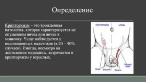 Когда опускаются яички у мальчиков узи