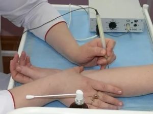 Можно ли удалять папилломы лазером во время месячных