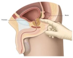 Как найти пальцем простату у мужчины