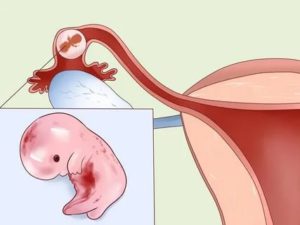 Можно ли заниматься интимной жизнью перед месячными
