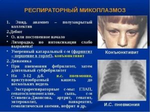 Как обнаружить микоплазмоз у ребенка