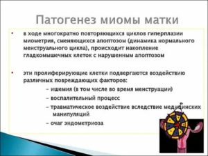 Миома матки этиология классификация клиника диагностика лечение