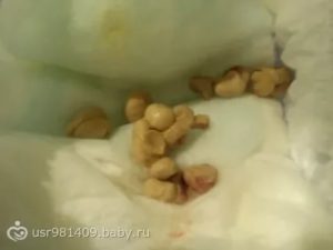 Почему у новорожденных идут месячные