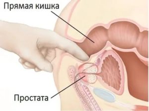 Как найти пальцем простату у мужчины