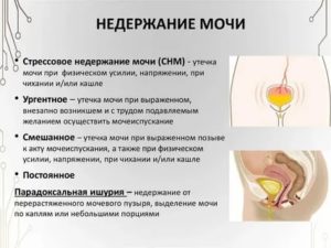 Почему при климаксе частое мочеиспускание у