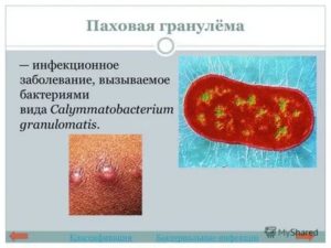 Что за болезнь донованозом