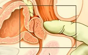 Описался во время массажа простаты