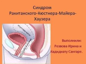 Климакс при синдроме рокитанского кюстнера