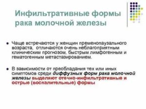 Что такое инфильтрирующий рак молочной железы 2 степени