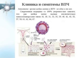 Какая может быть вирусная инфекция шейки матки