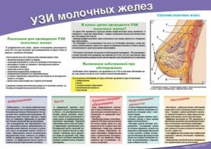 Можно ли пить алкоголь перед узи молочных желез