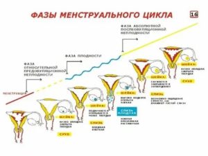 Можно ли ставить капельницы во время месячных