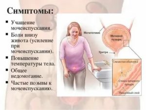 Почему при климаксе частое мочеиспускание у