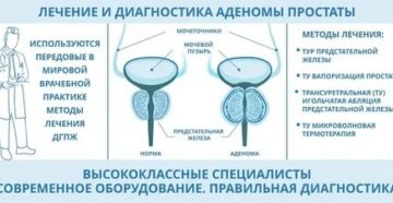 Заговоры от аденомы предстательной железы