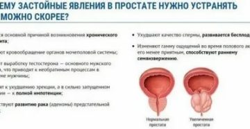 После лечения хронического простатита нет семяизвержения