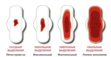 Почему прекратились месячные если в том месяце они были