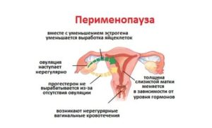 Сколько дней могут идти месячные в период пременопаузы