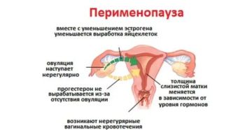 Сколько дней могут идти месячные в период пременопаузы Сколько дней могут идти месячные в период пременопаузы