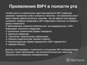 Как лечить стоматит при вич инфекции