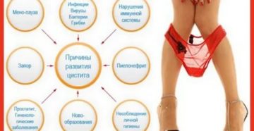Как только замерзнут ноги начинается цистит