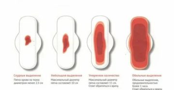 Почему месячные не вытекают на прокладку Почему месячные не вытекают на прокладку