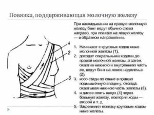 Какие нужны бинты на операцию молочной железы