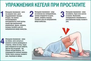 Упражнения кегеля при недержании мочи после операции рака простаты