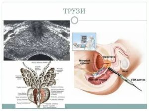 Можно ли заниматься сексом перед трузи предстательной железы