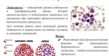 При простатите может быть повышенный уровень лейкоцитов