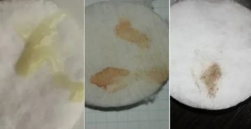 Почему идут желтые выделения вместо месячных Почему идут желтые выделения вместо месячных