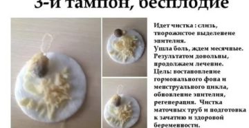 Можно ли вставлять тампоны с димексидом при месячных