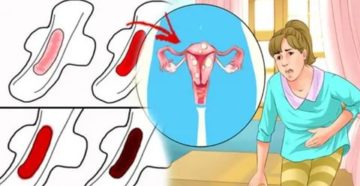 Что делать если месячные начались а у меня свидание с