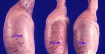 Как атрофируется яичко после операции