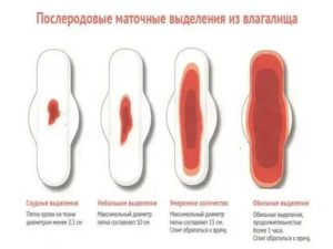 Почему когда заканчиваются месячные появляется неприятный запах