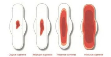 Почему когда заканчиваются месячные появляется неприятный запах Почему когда заканчиваются месячные появляется неприятный запах