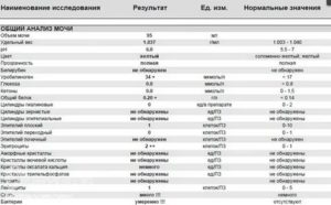 Можно ли определить уретрит по общему анализу мочи